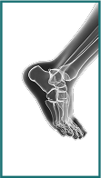 Foot & Ankle